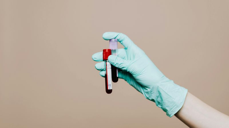 Top 10 Supplements to Test Before Use
