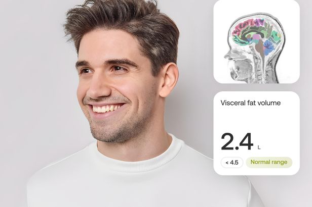 Measure what your wearables can’t